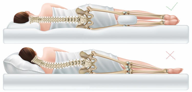 Dessin d'une femme allongée sur un lit avec son squelette apparemment montrant la bonne et la mauvaise posture