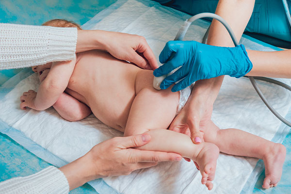 Bébé en cours de dépistage de la dysplasie de la hanche