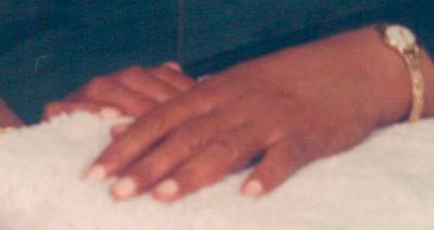 Photography of Lilly's hand before arthritis