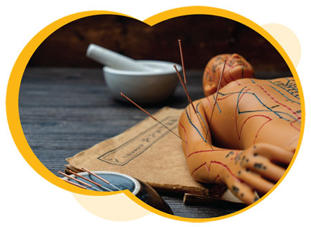 Une poupée avec les tracés des points méridiants et des aiguilles d'acupuncture