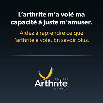 Ligne sur le vol de l’arthrite : L’arthrite m’a volé ma capacité à juste m’amuser.