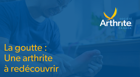La goutte: une arthrite à redécouvrir - Dr Michel Gagné